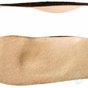 6725192083_detskie-stelki-ortopedicheskie.jpg